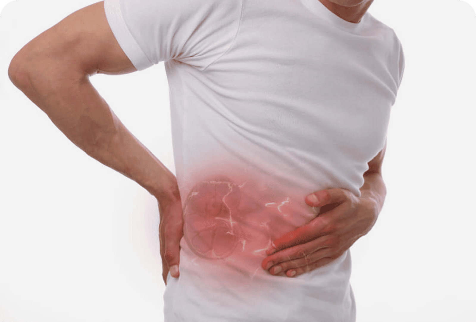 What are the first signs of kidney stones