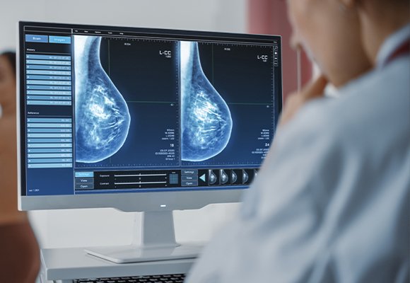 Imaging and screening for early detection