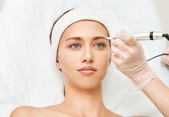 Brow lift procedure