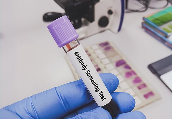 Antibody Screening — Antibody Screening Facility | Ruby Hall Clinic