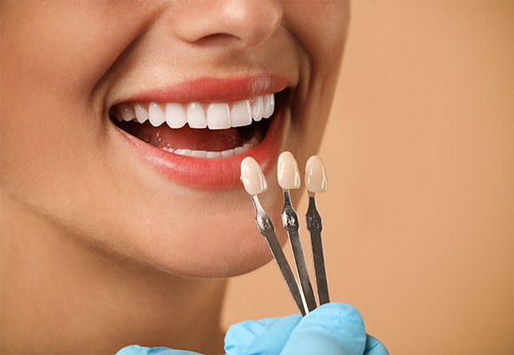 Dental Veneers — Dental Veneers | Ruby Hall Clinic