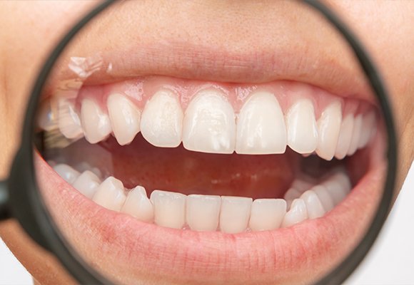 Oral Pathology Diseases And Cancers — Oral Pathology, Diseases, and Cancers | Ruby Hall Clinic
