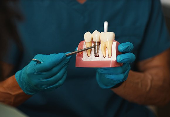 Oral And Maxillofacial Surgery — Oral and Maxillofacial Surgery | Ruby Hall Clinic
