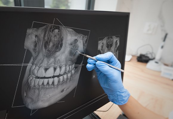 Oral Or Facial Deformities — Oral and Facial Deformities | Ruby Hall Clinic