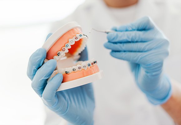 Orthodontics — Orthodontics | Ruby Hall Clinic