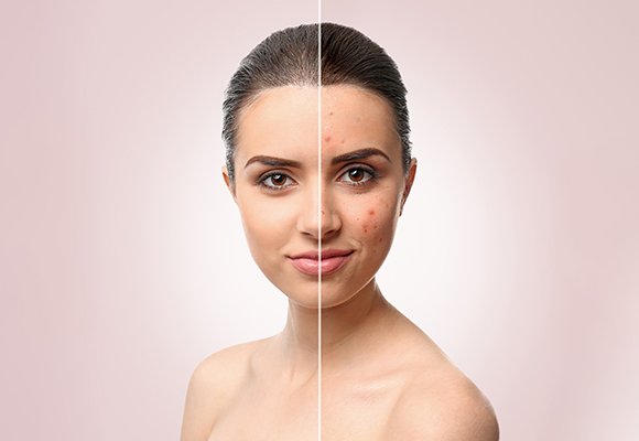 Cosmetic Dermatology — Clinical Dermatology | Ruby Hall Clinic