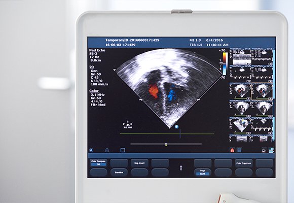 Ultrasonography And Colour Doppler — Ultrasonography and Colour Doppler | Ruby Hall Clinic