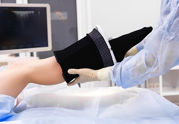 Deep vein thrombosis